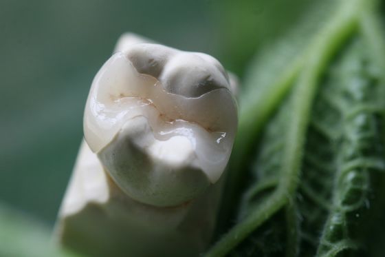 Het natuurlijke Kijken Al Tandkroon van Porseleinvernisjes EMAX