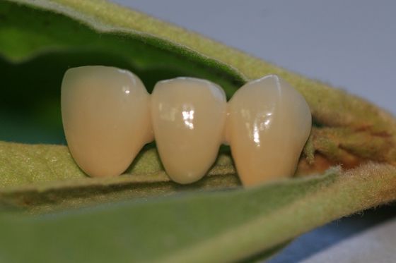 Samengestelde Tijdelijke Kroon van de hars de Natuurlijke Kleur voor Voorafgaande Tanden