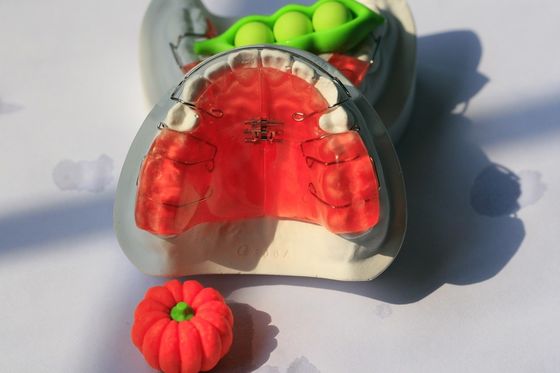 De Tandheelkunde Orthodontisch Tandtoestel van het douaneonderhoud