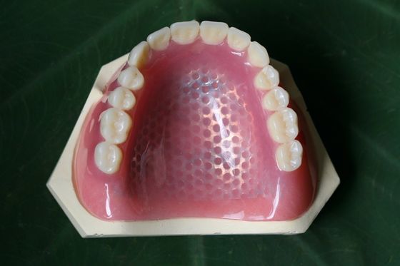 3D van het het Skelet Gedeeltelijk Gebit van het Drukmetaal het Metaalkader