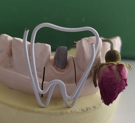 Metaal Tandpost en Kern na Endodontic-Behandeling