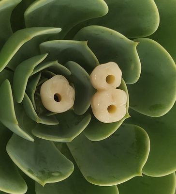 Endosseous Tandimplants Kroon