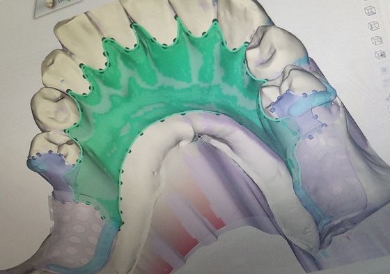 Het verwijderbare 3D Gedrukte Gedeeltelijke Kader van het Gebitmetaal
