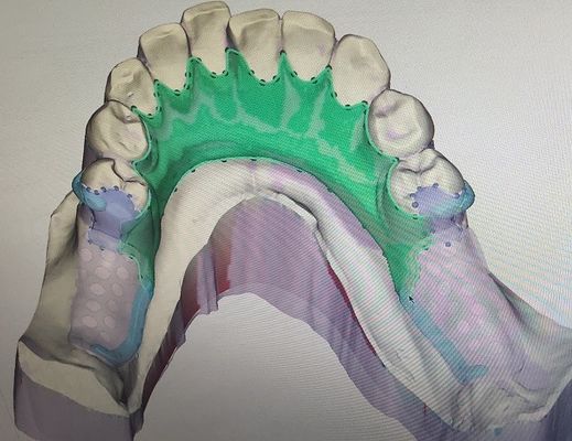 Het verwijderbare 3D Gedrukte Gedeeltelijke Kader van het Gebitmetaal