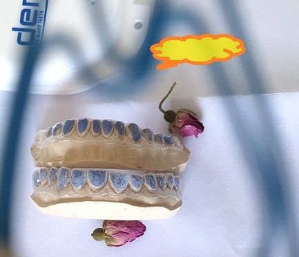 Douaneiso13485 Bleken Tray For Whitening Teeth