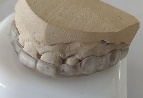 De Mondstuk van de Esthetics Lager Boog voor Tanden het Dichtklemmen