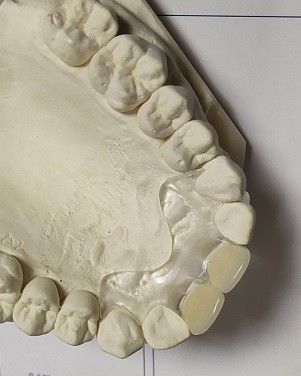 Het comfortabele Geschikte Zachte Onzichtbare Gebit van ISO13485 RPD