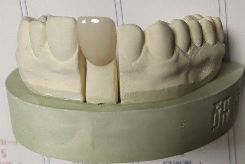 Het zirconiumdioxyde blokkeert Tand 3D Druk door CAD CAM Malen