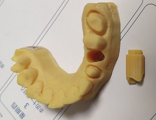 Model van de hoge Precisieiso13485 Trushine het Tand 3D Druk