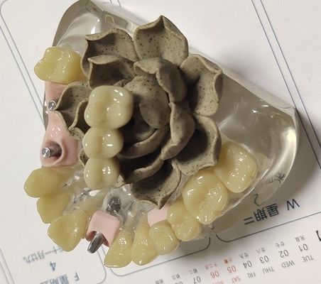 De Voorlopige Kroon van 100 Percentenbiocompatibility PMMA