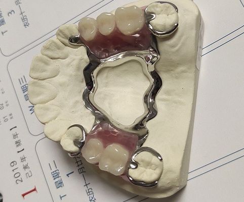 Maxillary van het de Legerings Gedeeltelijk Gebit van Cr van Boogco het Metaalkader