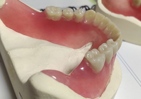 Koude van het Esthetics genas de Volledige Gebit Acryl Gedeeltelijk Gebit
