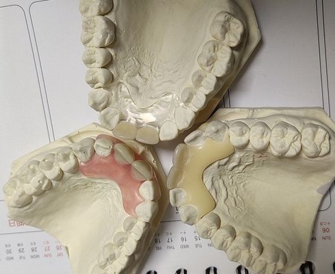 Het tijdelijke Zachte en Elastische Onzichtbare Gebit van Valplast