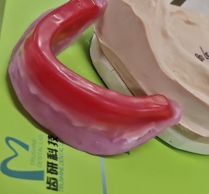 Blokken van het Trushine de Tandverslag voor Definitieve Volledige Gebitten