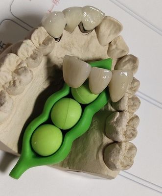 CAD CAM Ontwerp Tand 3D Druk