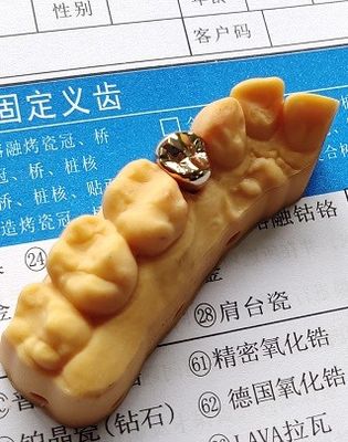 De goede Tandkroon van de Geschiktheids Hoge Kostbare Gouden Legering