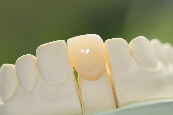 Natuurlijke Permanente Glas Ceramische Tandkroon voor Voorafgaande Tanden