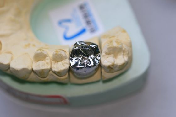 De hoogtepunt Gegoten Tandkroon van Onedel Metaallegeringen
