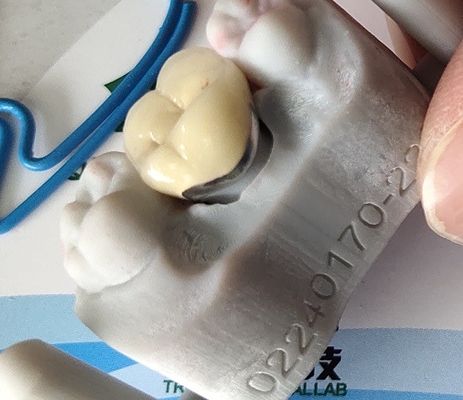 TanddieCAD van het Laboratoriumproduct CAM PFM Kroonporselein aan metaal wordt gesmolten