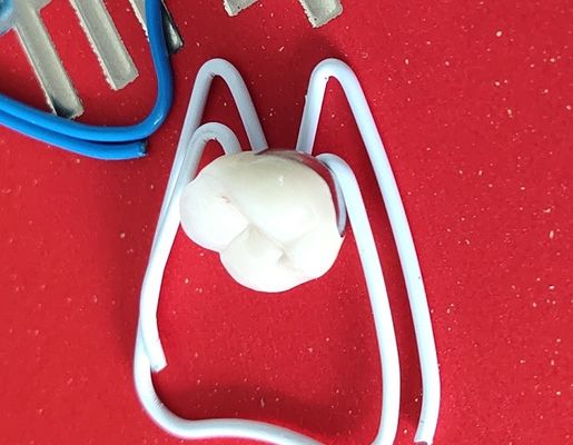 Van de de drukbrug van de laboratoriumpfm de Tandkroon 3D Tandkroon