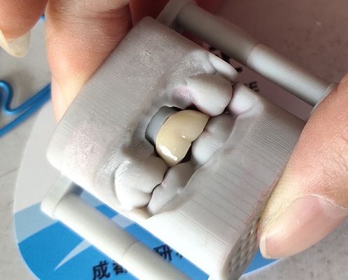 Van de de drukbrug van de laboratoriumpfm de Tandkroon 3D Tandkroon