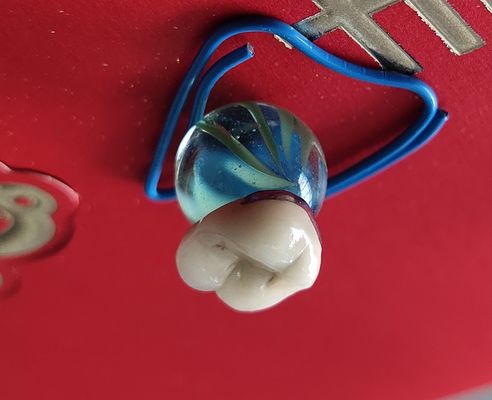 TanddieCAD van het Laboratoriumproduct CAM PFM Kroonporselein aan metaal wordt gesmolten