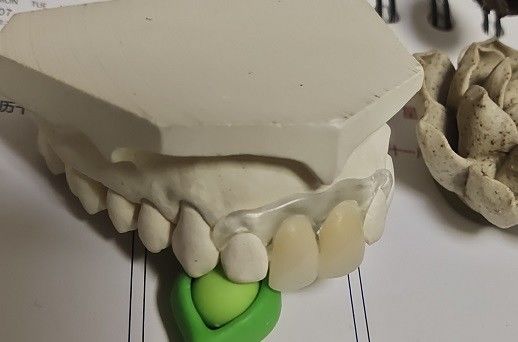 Het tijdelijke Zachte en Elastische Onzichtbare Gebit van Valplast
