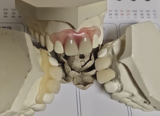 Het comfortabele Geschikte Zachte Onzichtbare Gebit van ISO13485 RPD