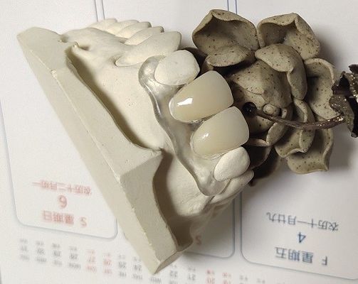 Het zachte Elastische Nylon Onzichtbare Gebit van Trushine