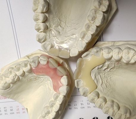 Het Vrije Onzichtbare Gebit van het harsmetaal voor Allergische Patiënt